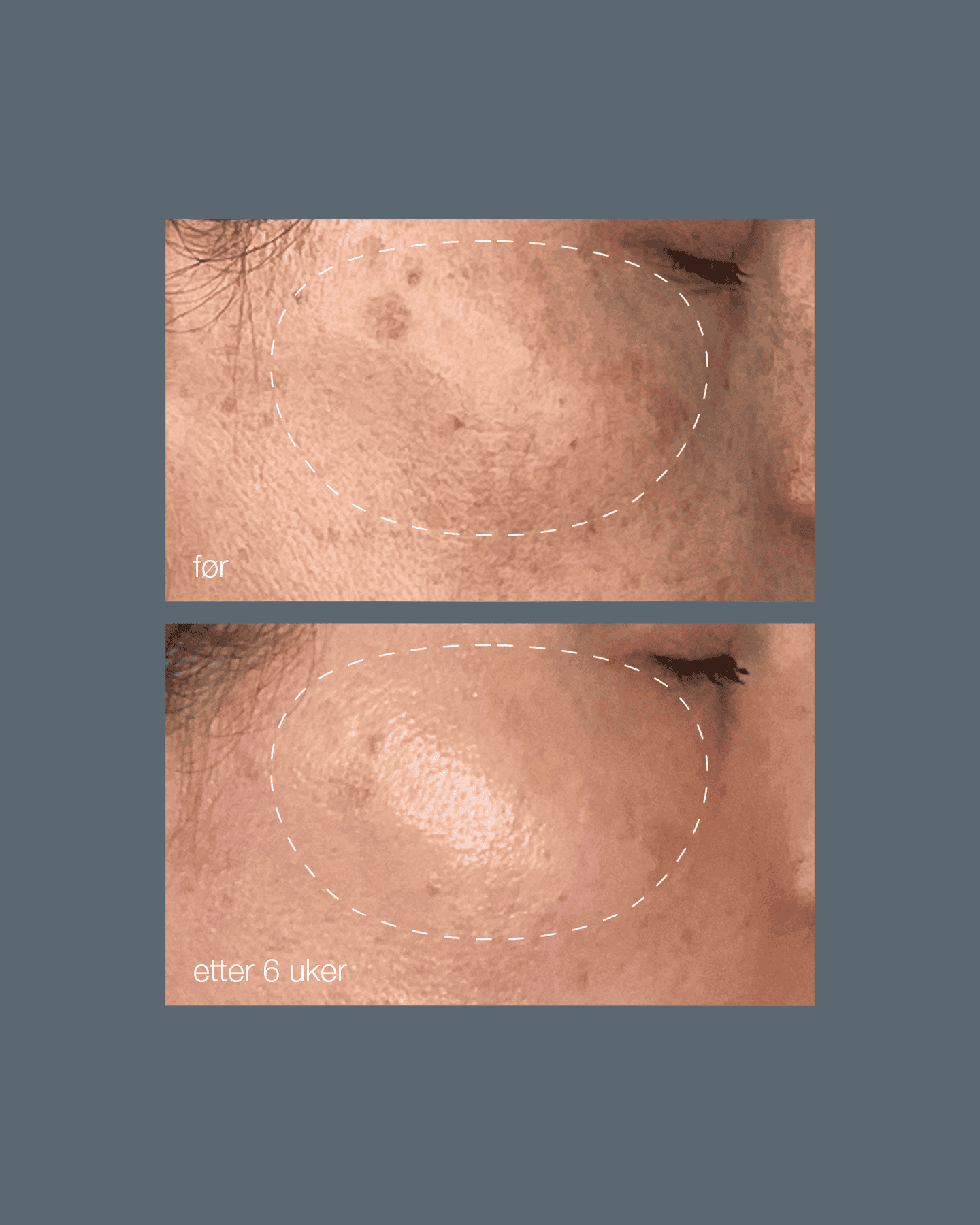 Phyto Nature Lifting Eye Cream - Image 7